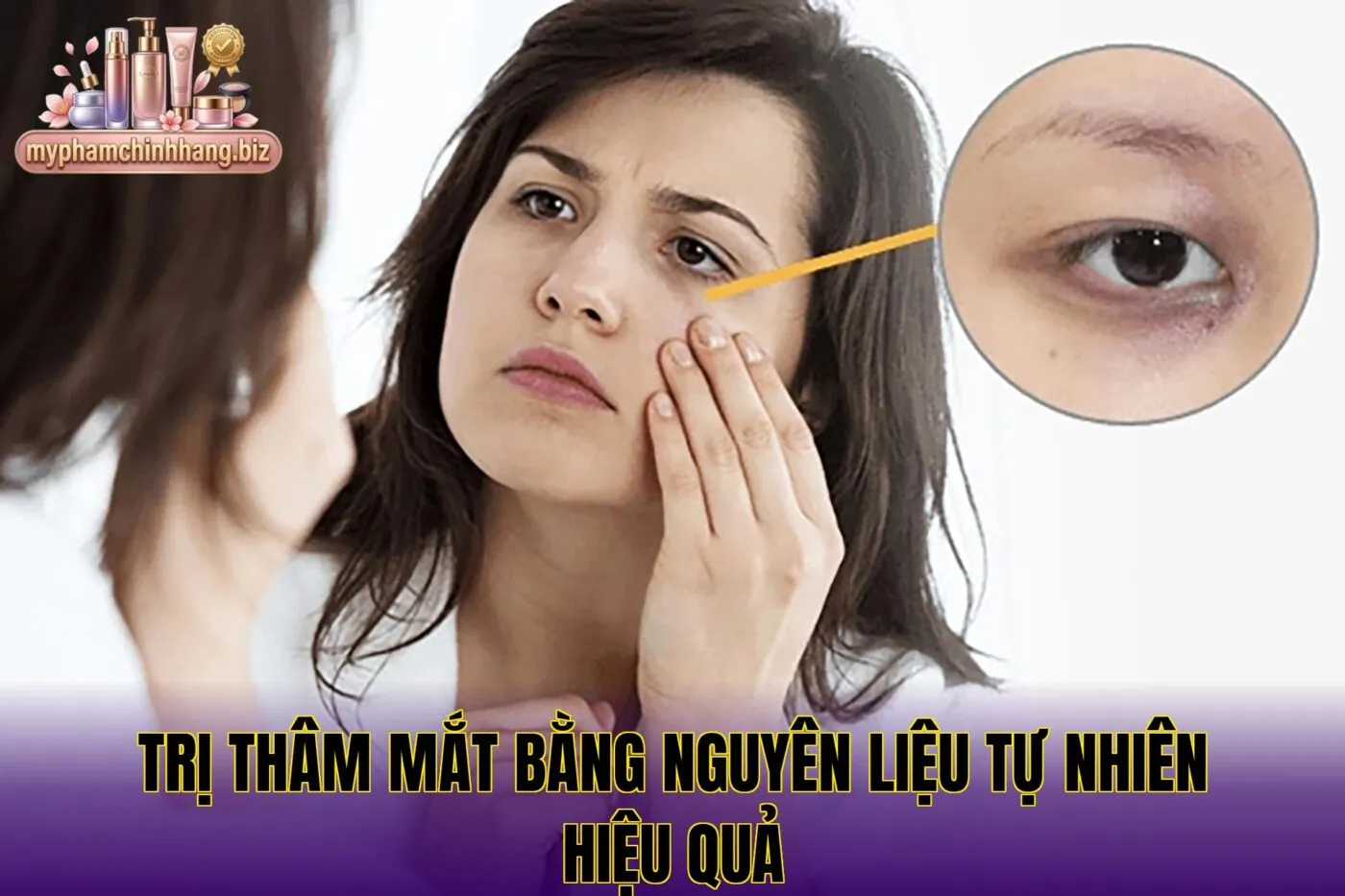 Trị thâm mắt bằng nguyên liệu tự nhiên hiệu quả